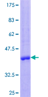 12.5% SDS-PAGE Stained with Coomassie Blue.